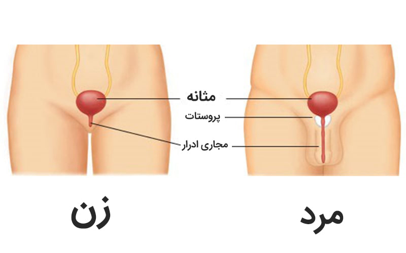 تنگی مجرای ادرار